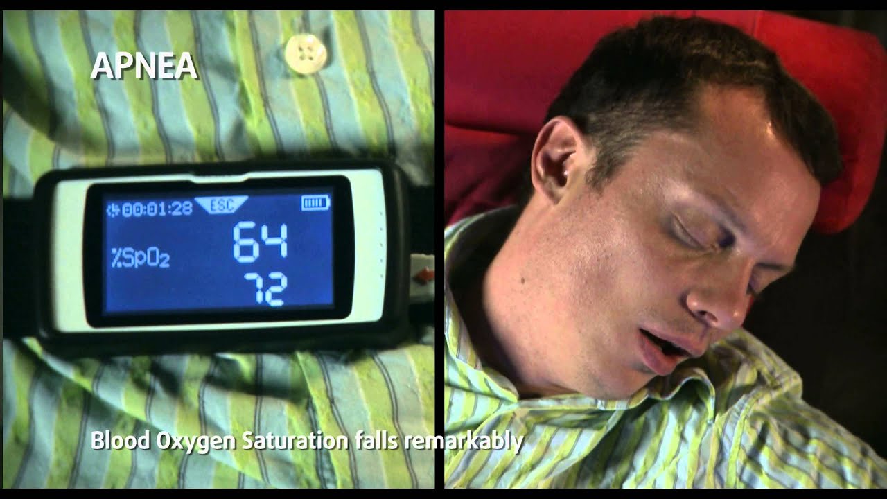 Clinical Insight: Sleep test with MIR Spirodoc™ Spirometer with Oximetry option
